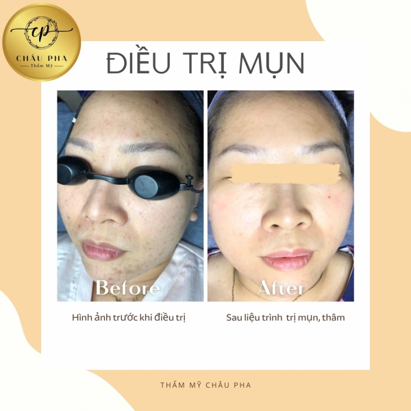 Liệu Trình Trị Thâm