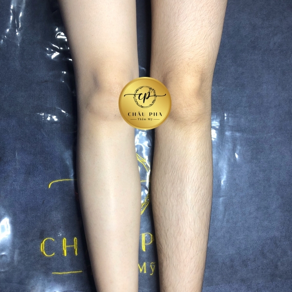 Triệt Chân Vĩnh Viễn